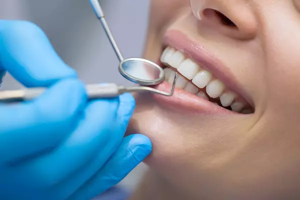 Where can I get Veneers in South Huntington? | Cosmetic Dentist Huntington NY | Dentistry By Design PC