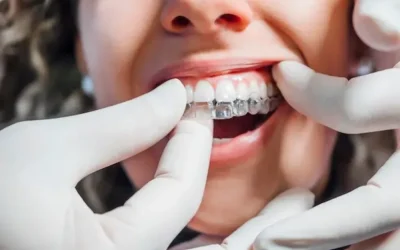 Can Invisalign Fix Crowded Teeth?